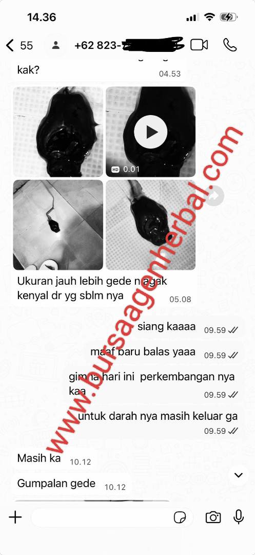 Testimoni